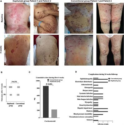 Dupilumab effectively and rapidly treats bullous pemphigoid by inhibiting the activities of multiple cell types